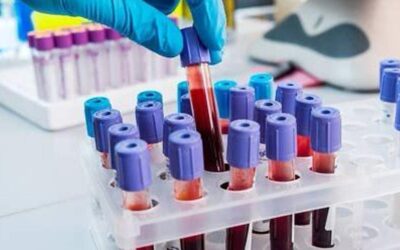 Analizele medicale în anxietate: ce trebuie să verifici și de ce contează